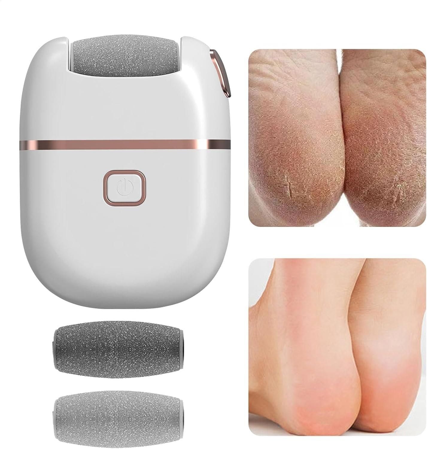 Smart Electronic Pedicure Tool for Smooth & Soft Feet