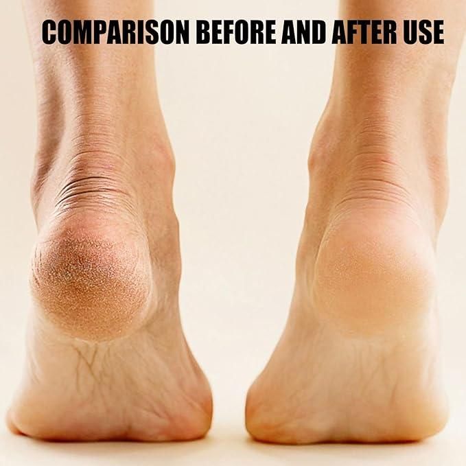 Smart Electronic Pedicure Tool for Smooth & Soft Feet